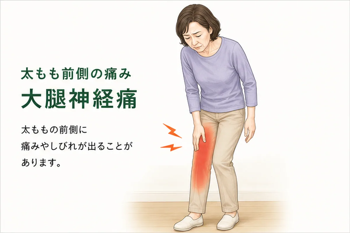 太ももの前側に痛みやしびれを感じている女性のイラスト