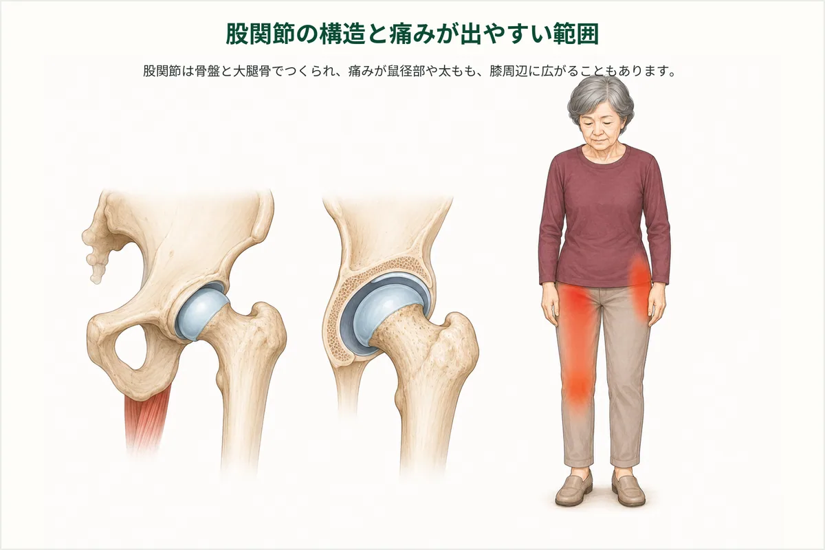 股関節の構造と脚の付け根から太ももに痛みが出る範囲