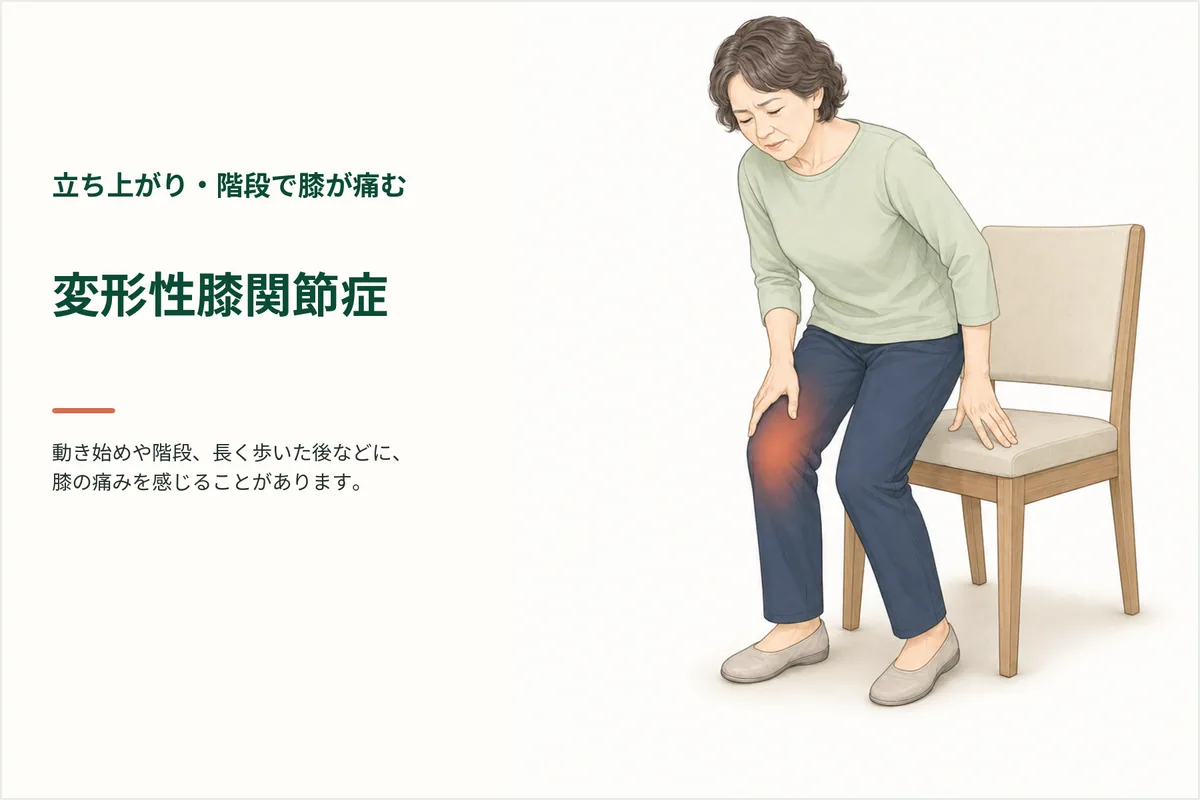 椅子から立ち上がるときに膝の痛みを感じる女性のイラスト
