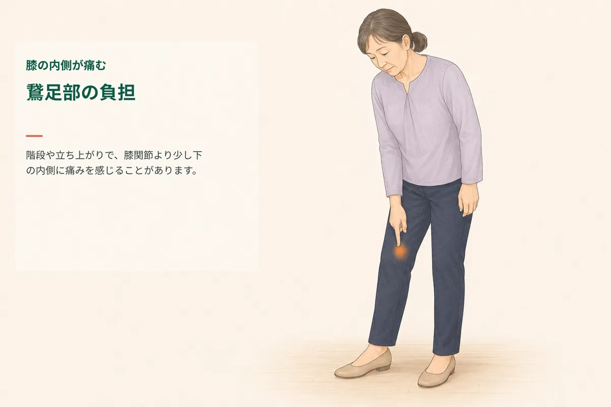 階段で膝の内側から少し下の痛みを気にする女性のイラスト