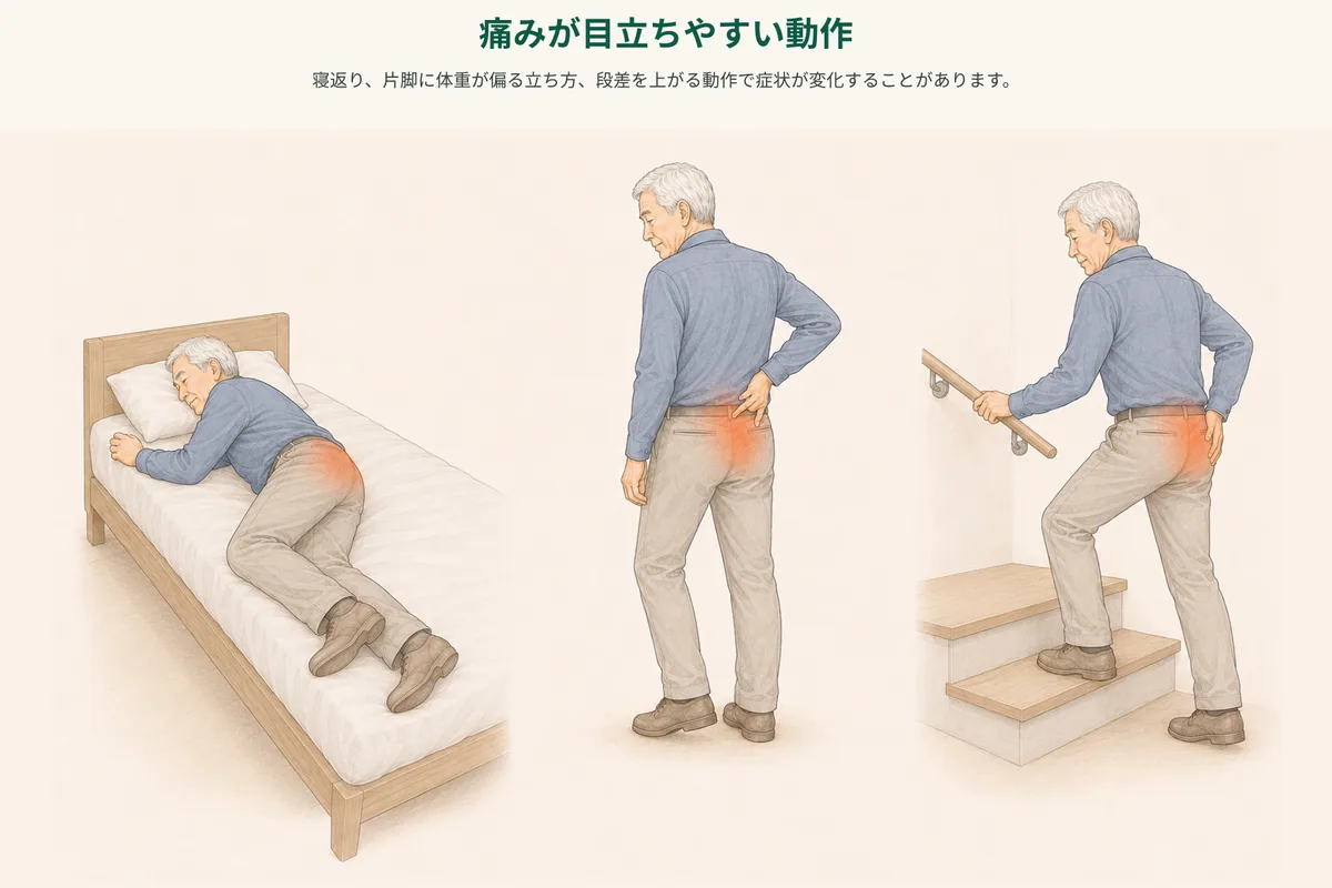立ち上がり、階段、片脚立ちで骨盤周辺の負担を振り返る図
