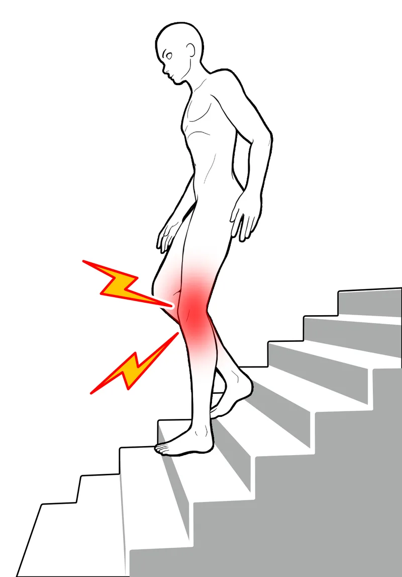 階段で膝に痛みが出る高齢女性