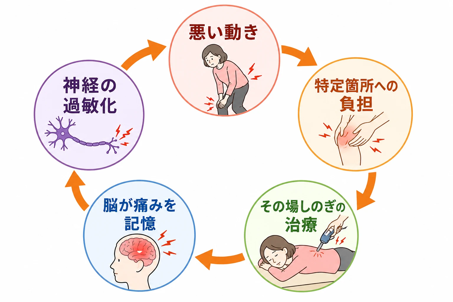 悪い動きから神経の過敏化まで続く悪循環の図解